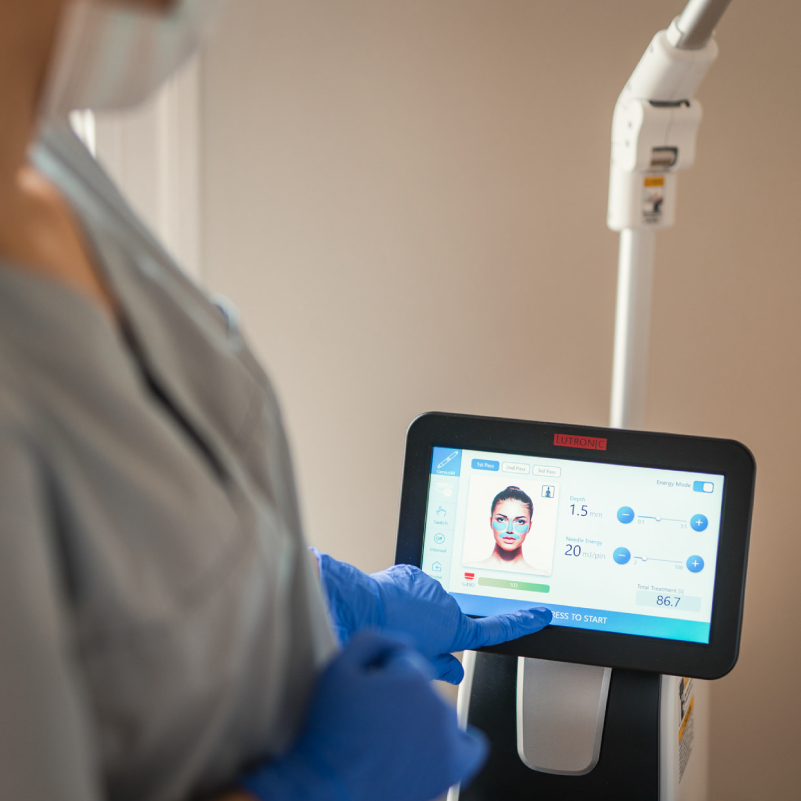 Microneedling mit Radiofrequenz: Innovations-Behandlung für die Hautverjüngung und -regeneration