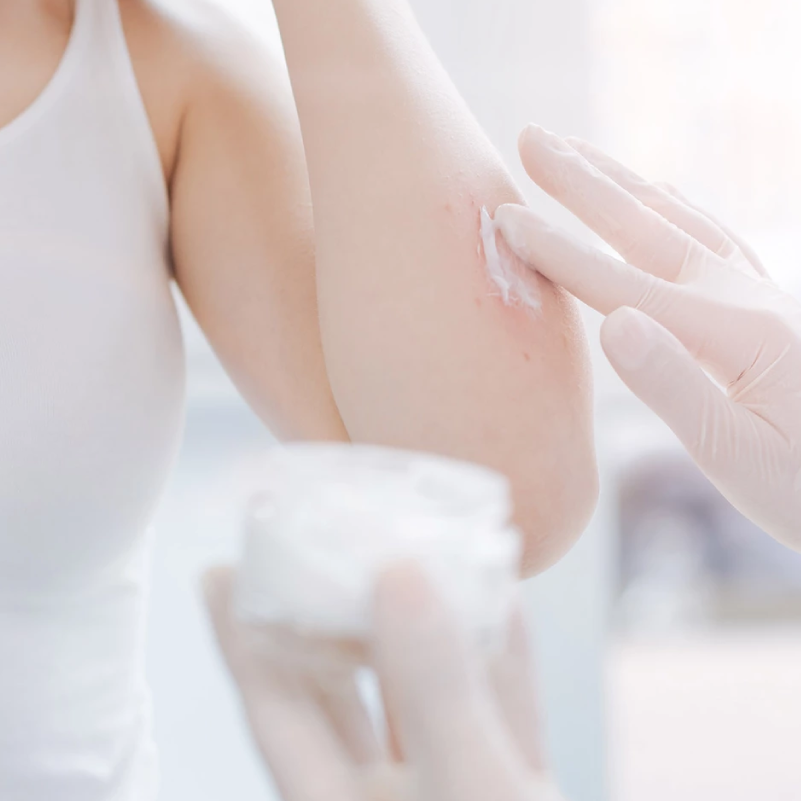 Nesselsucht (Urtikaria)